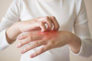 a woman scratching her hand due to itchy skin emphasising the question does hard water cause skin problems