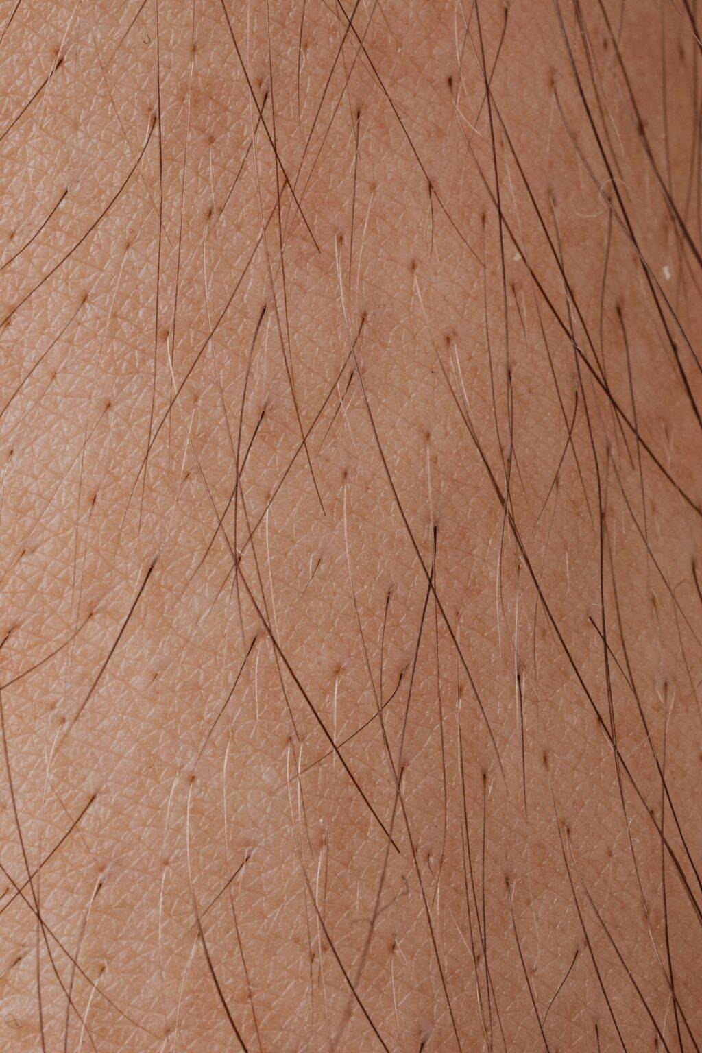 Does hard water cause hair loss? A look at what the science says.