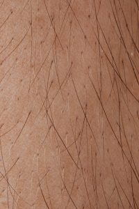 close up of skin and hair follicles relating to does hard water cause hair loss