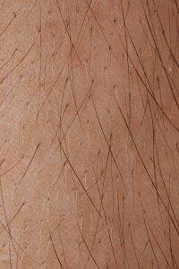 close up of skin and hair follicles relating to does hard water cause hair loss